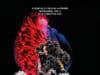 BJORK: Cornucopia Concert Film Released BJORK, CORNCOPIA